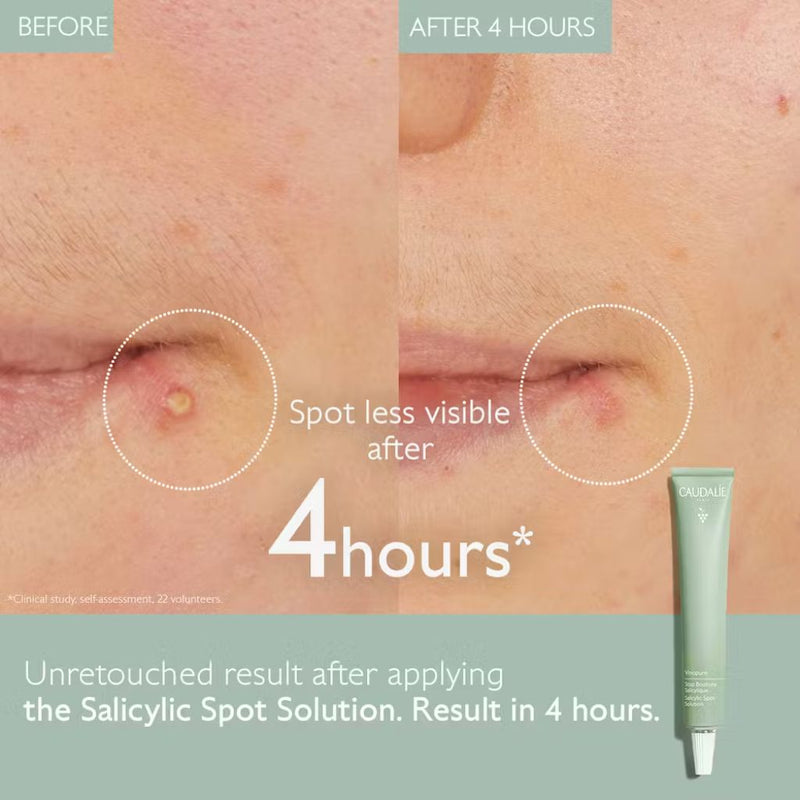 Caudalie Vinopure Salicylic Spot Solution