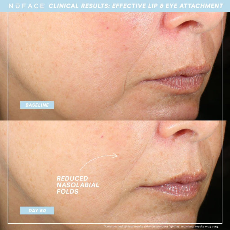NuFace Lip + Eye Trinity+ Attachment