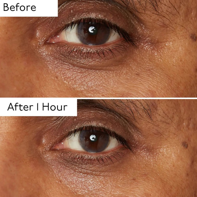 By Terry Hyaluronic Global Eye Serum