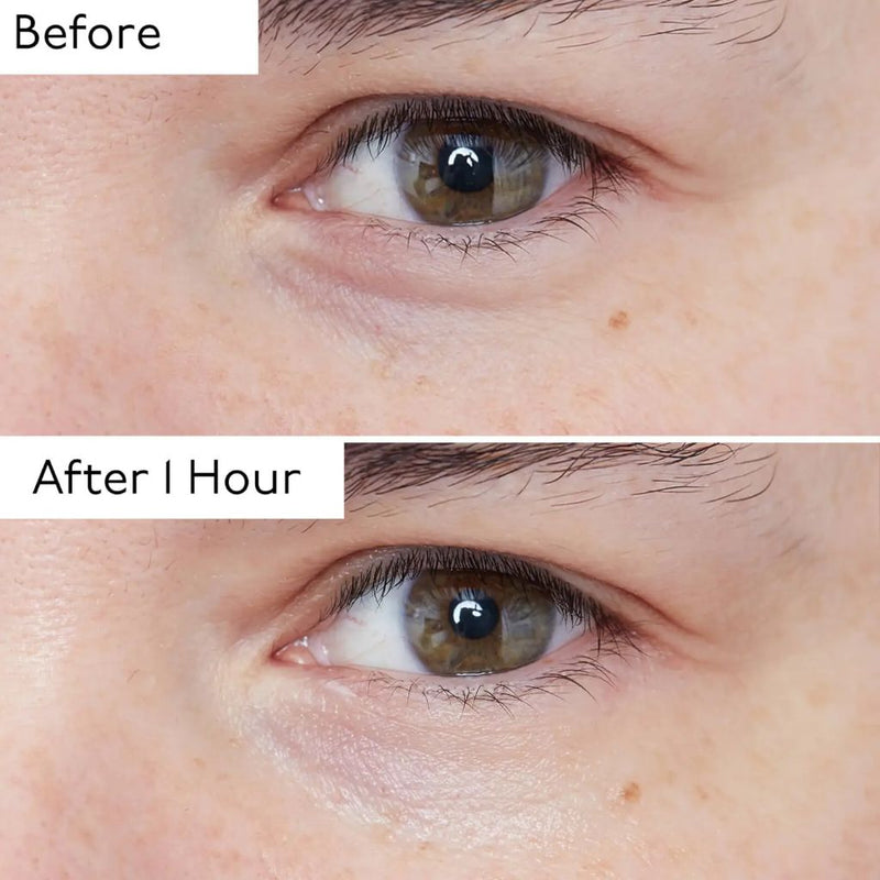 By Terry Hyaluronic Global Eye Serum