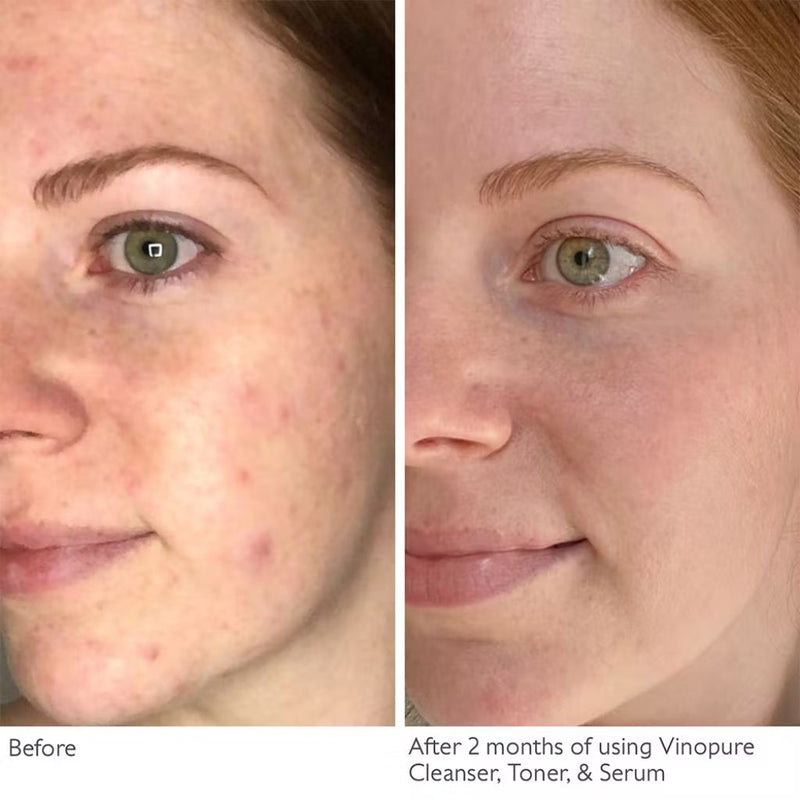 Caudalie Vinopure Purifying Gel Cleanser