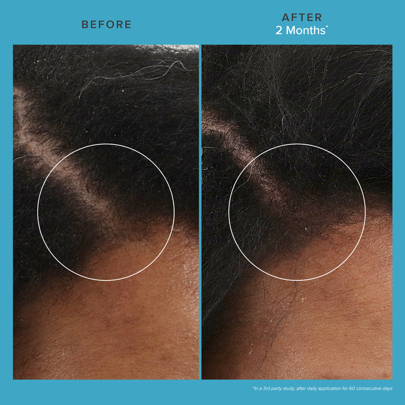 Living Proof Scalp Care Revitalizing Treatment