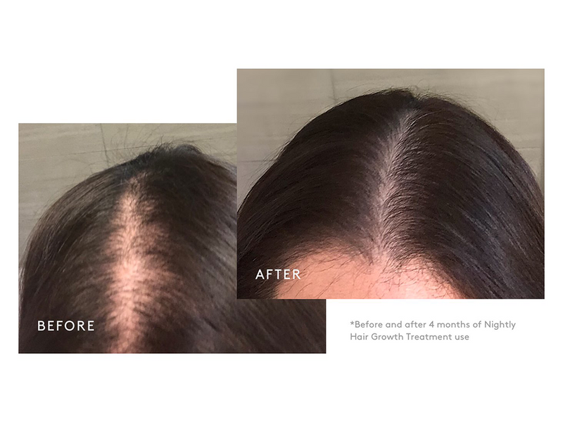 Virtue Flourish Hair Rejuvenation Treatment (Drug Free)